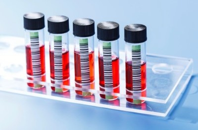 其他生物制品行業深度調整，前景依然可期